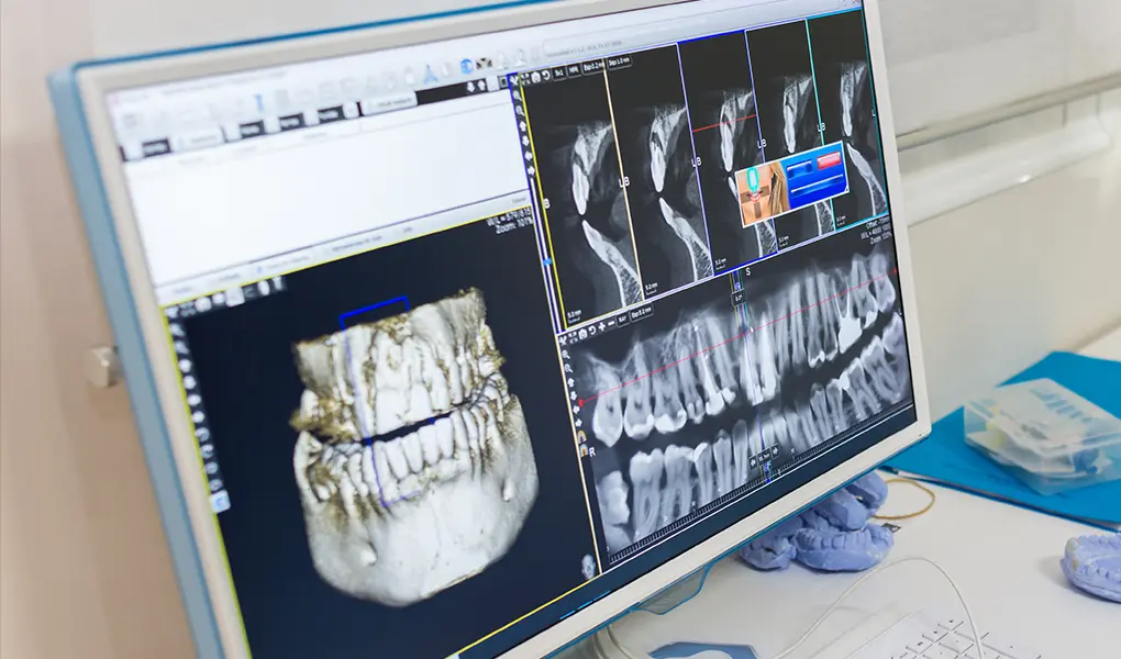 お口の構造を立体的に捉える、デジタルレントゲン・歯科用CT
