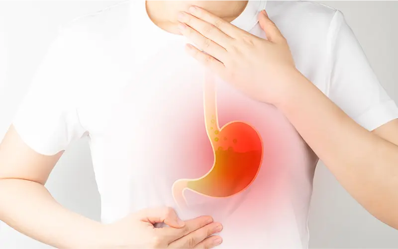 食道の症状（胸やけ・のどの違和感など）
